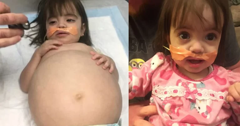 Dad performs a life-saving transplant on his daughter to save her.