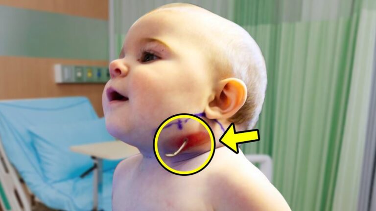 Little Girl Kept Scratching Her Neck. Doctors Were Shocked When They Discovered The Reason!