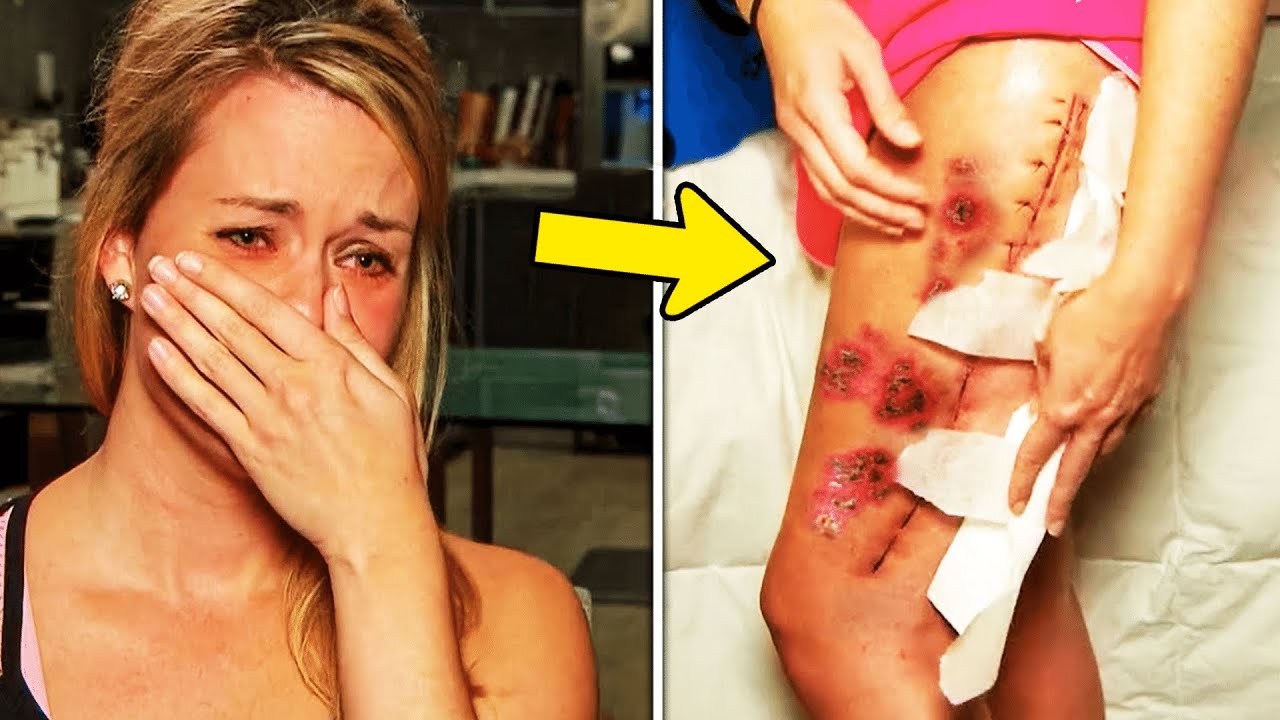 Woman’s Spots Hide a Shocking Secret – Doctor Freaks Out!