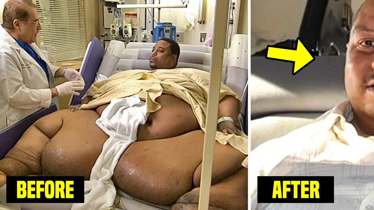 Remember This Man Who Weighed 1022 Pounds? This Is How He Looks Now!